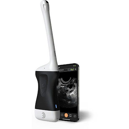 C3 HD3 Convex Handheld Portable Wireless Ultrasound Scanner