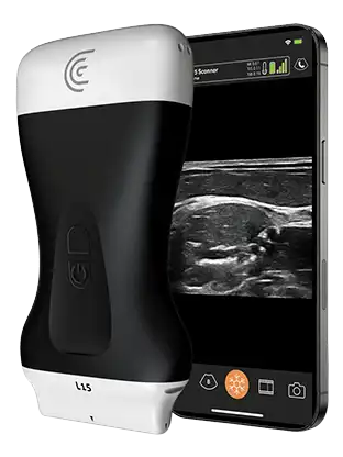 L15 HD3 High Freq Linear Handheld Portable Wireless Ultrasound Scanner