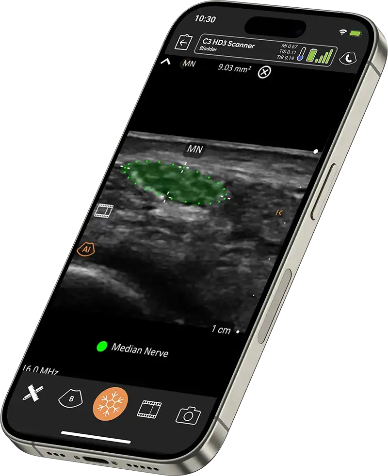 L20 HD3 Ultra High Freq Linear Handheld Portable Wireless Ultrasound Scanner